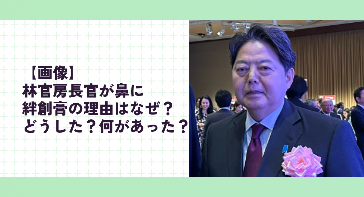 【画像】林官房長官が鼻に絆創膏の理由はなぜ？どうした？何があった？